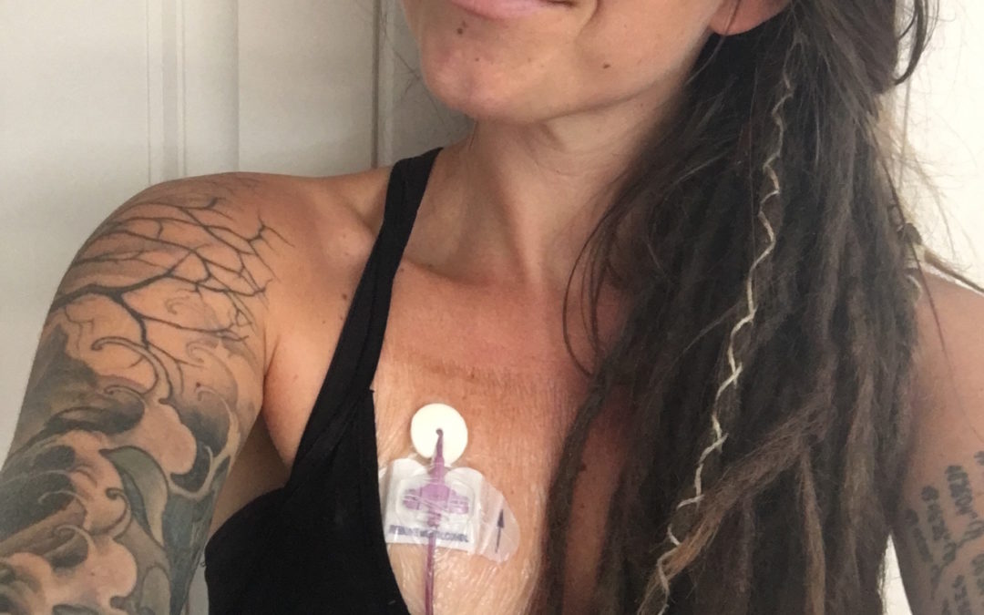 Lyme Disease Treatment: When You Can’t Keep Going